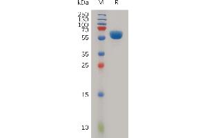 Human L Protein, hFc Tag on SDS-PAGE under reducing condition.