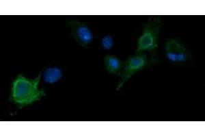 Image no. 3 for anti-Parvin, alpha (PARVA) antibody (ABIN1496445) (Parvin alpha anticorps)