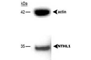 Western blot analysis of NTHL1 in A-549 cells using NTHL1 polyclonal antibody . (Nth Endonuclease III-Like 1 (NTHL1) anticorps)