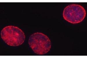 IF analysis of SHQ1 using anti-SHQ1 antibody (ABIN7599205). (SHQ1 anticorps  (AA 1-277))