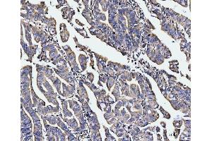 IHC analysis of EDC4 using anti-EDC4 antibody (ABIN7599694).