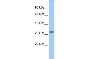WB Suggested Anti-FGF13 Antibody Titration: 0. (FGF13 anticorps  (Middle Region))