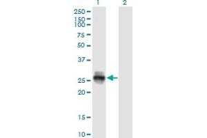 Western Blot analysis of KLK4 expression in transfected 293T cell line by KLK4 monoclonal antibody (M09), clone 2A4. (Kallikrein 4 anticorps  (AA 159-254))