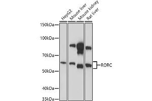 Western blot analysis of extracts of various cell lines, using RORC antibody (ABIN6132603, ABIN6147079, ABIN6147080 and ABIN6214413) at 1:1000 dilution. (RORC anticorps  (AA 120-320))