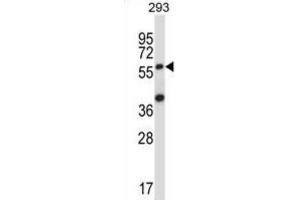 Western Blotting (WB) image for anti-Suppressor of Cytokine Signaling 6 (SOCS6) antibody (ABIN2997743) (SOCS6 anticorps)