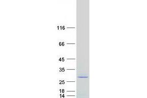 Validation with Western Blot