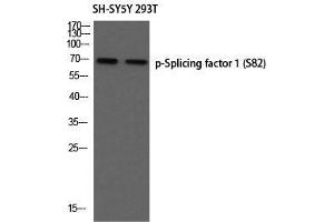 Western Blot (WB) analysis of SH-SY5Y 293T using p-Splicing factor 1 (S82) antibody. (Splicing Factor 1 anticorps  (pSer82))