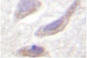 Image no. 1 for anti-Synuclein, alpha (SNCA) (pSer129) antibody (ABIN318305) (SNCA anticorps  (pSer129))