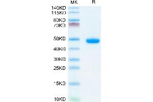 Mouse AGER on Tris-Bis PAGE under reduced condition.
