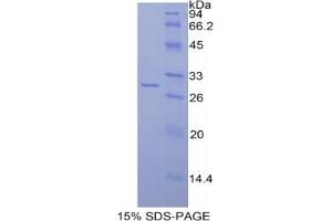 SDS-PAGE analysis of Rat IRAK2 Protein. (IRAK2 Protéine)