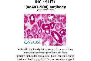 Image no. 2 for anti-Slit Homolog 1 (SLIT1) (AA 487-504) antibody (ABIN1739431)