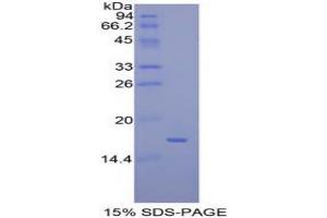 Mucosae Associated Epithelia Chemokine protein