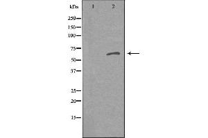 Western blot analysis of extracts from K562 cells using RANBP6 antibody.