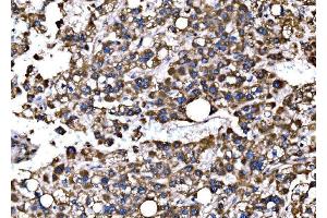 IHC analysis of Bim/BCL2L11 using anti-Bim/BCL2L11 antibody (ABIN7602855).