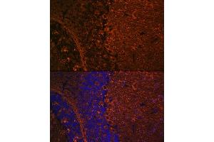 Immunofluorescence analysis of mouse brain using βIII-Tubulin/β3-Tubulin Rabbit mAb (ABIN7271049) at dilution of 1:100 (40x lens).