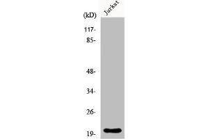 Western Blot analysis of HT29 cells using FGF-22 Polyclonal Antibody