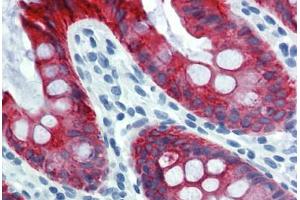 Colon, Human: Formalin-Fixed, Paraffin-Embedded (FFPE) (Cytokeratin 18 anticorps)
