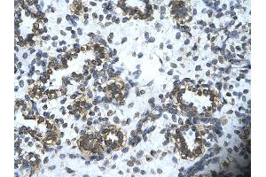 Rabbit Anti-HHEX Antibody Catalog Number: ARP31443  Paraffin Embedded Tissue: Human alveolar cell  Cellular Data: Epithelial cells of renal tubule Antibody Concentration:  4.