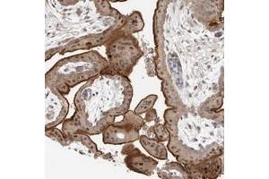 Immunohistochemical staining of human placenta with KIAA1009 polyclonal antibody  shows strong membranous and nuclear positivity in trophoblastic cells. (KIAA1009 (KIAA1009) anticorps)