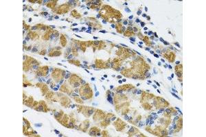 Immunohistochemistry of paraffin-embedded Human stomach using HAPLN1 Polyclonal Antibody at dilution of 1:100 (40x lens). (HAPLN1 anticorps)