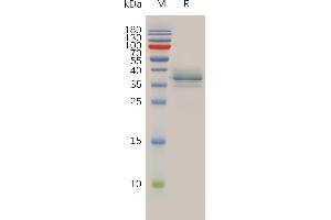 Human A Protein, His Tag on SDS-PAGE under reducing condition.