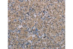 Immunohistochemistry of Human brain  using MGLL Polyclonal Antibody at dilution of 1:40 (MGLL anticorps)