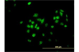 Immunofluorescence of monoclonal antibody to TFAP4 on HeLa cell. (TFAP4 anticorps  (AA 93-192))