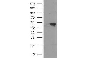 Western Blotting (WB) image for anti-Retinoblastoma Binding Protein 7 (RBBP7) antibody (ABIN1500625)