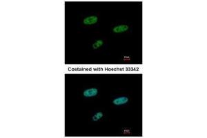 ICC/IF Image Immunofluorescence analysis of paraformaldehyde-fixed HeLa, using SAMHD1, antibody at 1:500 dilution. (SAMHD1 anticorps  (Internal Region))