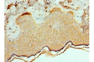 Immunohistochemistry of paraffin-embedded human skin tissue using ABIN7172544 at dilution of 1:100