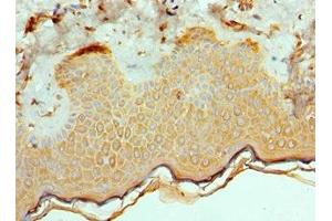Immunohistochemistry of paraffin-embedded human skin tissue using ABIN7172544 at dilution of 1:100 (ETV6 anticorps  (AA 1-300))