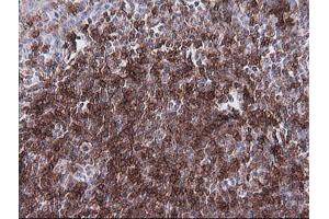 Immunohistochemistry (IHC) image for anti-T-cell surface glycoprotein CD1c (CD1C) antibody (ABIN2670667) (CD1c anticorps)