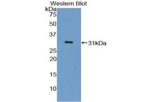 Western blot analysis of the recombinant protein. (ASK1 anticorps  (AA 693-933))