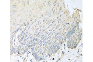 Immunohistochemistry of paraffin-embedded Human esophagus using SGCB Polyclonal Antibody at dilution of 1:100 (40x lens). (SGCB anticorps)