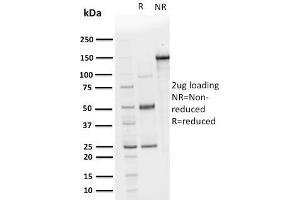 SDS-PAGE Analysis Purified CHP2 Mouse Monoclonal Antibody (CPTC-CHP2-1). (Chp2 anticorps)
