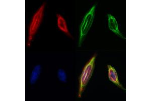 ABIN6260189 and ABIN6268682 staining Hela by IF/ICC.