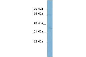 WB Suggested Anti-YTHDF1  Antibody Titration: 0. (YTHDF1 anticorps  (Middle Region))