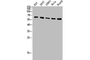 Western Blot analysis of 823 293T 22RV1 Hela HepG2 cells using ATP5A Polyclonal Antibody (ATP5A1 anticorps  (Internal Region))
