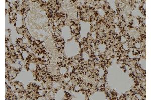 ABIN6276865 at 1/100 staining Rat lung tissue by IHC-P.