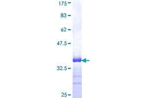 Image no. 1 for Slit Homolog 3 (SLIT3) (AA 1371-1470) protein (GST tag) (ABIN1320566)
