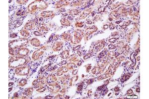 Formalin-fixed and paraffin embedded human kidney labeled with Anti-AMPK beta 2 Polyclonal Antibody, Unconjugated (ABIN751858) at 1:200 followed by conjugation to the secondary antibody and DAB staining