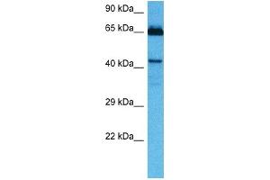 Host:  Mouse  Target Name:  HOXA10  Sample Tissue:  Mouse Kidney  Antibody Dilution:  1ug/ml (HOXA10 anticorps  (Middle Region))