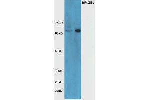 Lane 1: mouse brain lysate Lane 2: Raji cell lysate probed with Rabbit Anti-HRG beta 1 Polyclonal Antibody, Unconjugated (ABIN716051) at 1:300 overnight at 4 °C. (Hrg beta 1 (AA 65-150) anticorps)