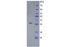 Image no. 1 for Interleukin 18 (IL18) (AA 36-192) (Active) protein (His tag) (ABIN6239812)