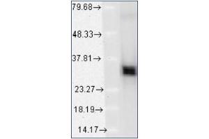 Western blot analysis of HO-1 using a 1/1000 dilution of Heme oxygenase 1 / HMOX1 Antibody Cat. (HMOX1 anticorps  (N-Term))