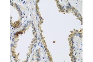 Immunohistochemistry of paraffin-embedded Human prostate using GFER Polyclonal Antibody at dilution of 1:100 (40x lens). (GFER anticorps)