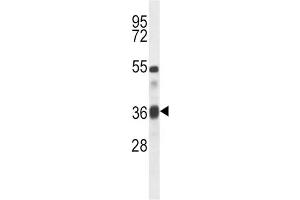 Western Blotting (WB) image for anti-Transforming Growth Factor, beta 1 (TGFB1) antibody (ABIN5016291) (TGFB1 anticorps)