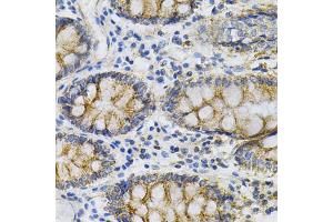 Immunohistochemistry of paraffin-embedded human colon using PTPRA Antibody (ABIN5971026) at dilution of 1/100 (40x lens).
