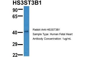 Host:  Rabbit  Target Name:  HS3ST3B1  Sample Type:  Human Fetal Heart  Antibody Dilution:  1. (HS3ST3B1 anticorps  (N-Term))