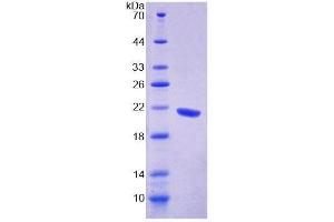 SDS-PAGE analysis of Human GFM1 Protein. (GFM1 Protéine)